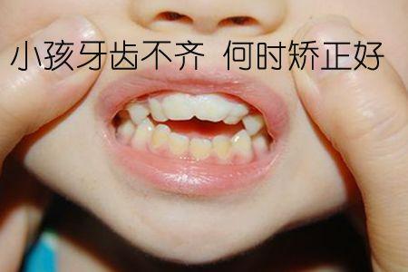 儿童牙齿矫正视频,视频教程带你轻松掌握矫正技巧